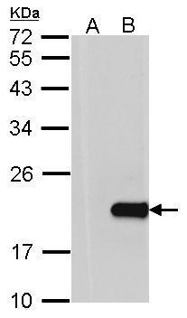 HPCAL1 antibody [N1C3]