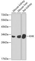Ketohexokinase antibody