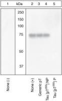 Tau (phospho Thr205) antibody