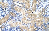 MTHFSD antibody, N-term