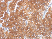 ADFP antibody [ADFP/1494]