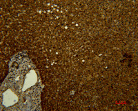 Transferrin antibody [10G3]