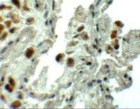 SPTLC1 antibody