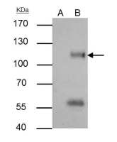 ATG9A antibody