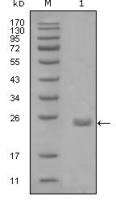 AXL antibody [1B3A2]