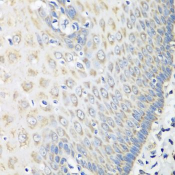 OXCT1 antibody