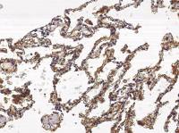 S100A10 antibody [03]