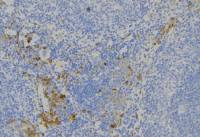 ALPK1 antibody