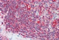 PSME2 antibody, C-term