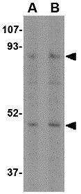 NHE-1 antibody