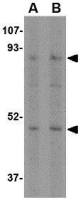 NHE-1 antibody