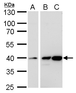Calponin 3 antibody