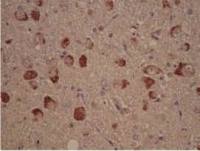 Casein Kinase 1 delta antibody