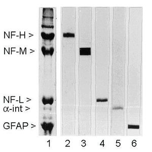 NF-M antibody [3H11]