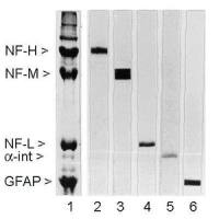 NF-M antibody [3H11]