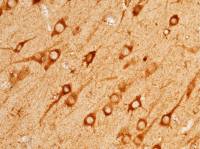 Angiotensinogen antibody [034]