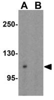 GRIP1 antibody