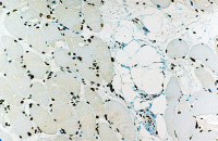 Emerin antibody [4G5]