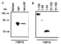 TBP antibody [1TBP18]
