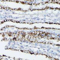 Aquaporin 3 antibody