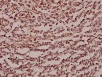 Endo180 antibody