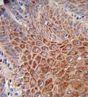 IGH antibody, C-term