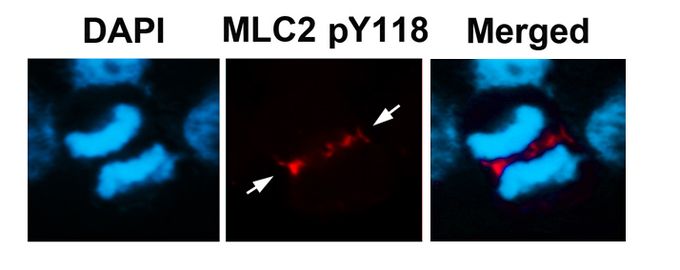 Myosin Light Chain 2 (MLC-2v) (phospho Tyr118) antibody