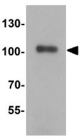 KAP1 antibody