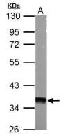 AMPK gamma 1 antibody