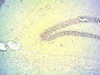 DIO2 antibody, Internal