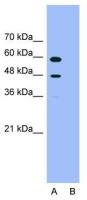 PDCD4 antibody, N-term