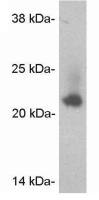 Caveolin 2 antibody