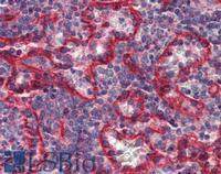 HLA-E antibody [MEM-E/07] (Biotin)