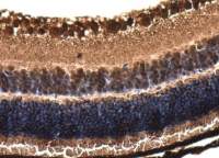 Phosducin / PDC antibody