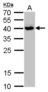 SH3GL3 antibody