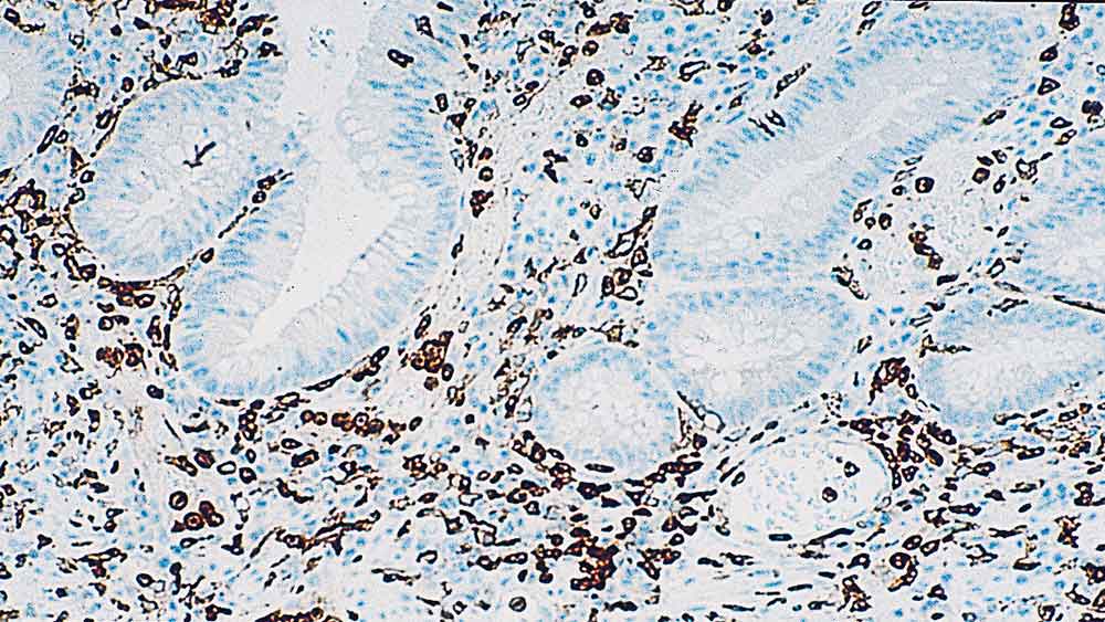 CD16 antibody [2H7]