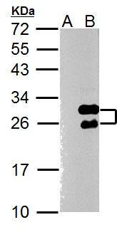 Twist1 antibody [N1C3]