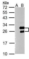 Twist1 antibody [N1C3]