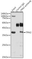 Tropomyosin 2 antibody