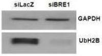 Histone H2B (ubiquitinated) antibody [NRO3]