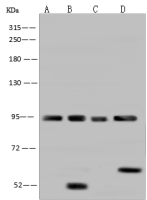 AFG3L2 antibody