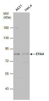 EYA4 antibody