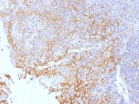 beta Catenin antibody [5H10]
