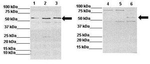 IL13 Receptor alpha 2 antibody, N-term