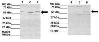 IL13 Receptor alpha 2 antibody, N-term