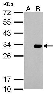 HSV tag antibody