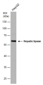 Hepatic lipase antibody [N1C1]