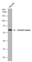 Hepatic lipase antibody [N1C1]