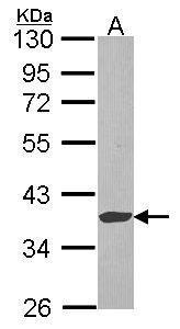 EXTL2 antibody [N2C3]