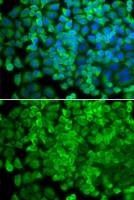 Galactosidase alpha antibody